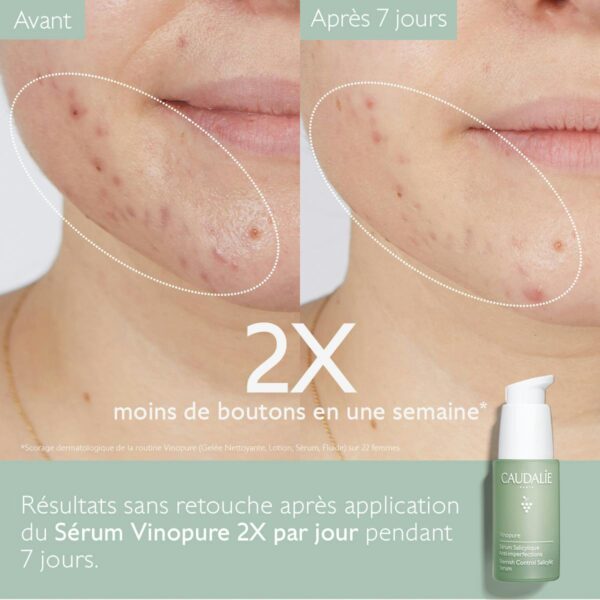 Caudalie Vinopure Serum 30ml - Image 4