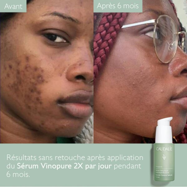 Caudalie Vinopure Serum 30ml - Image 7