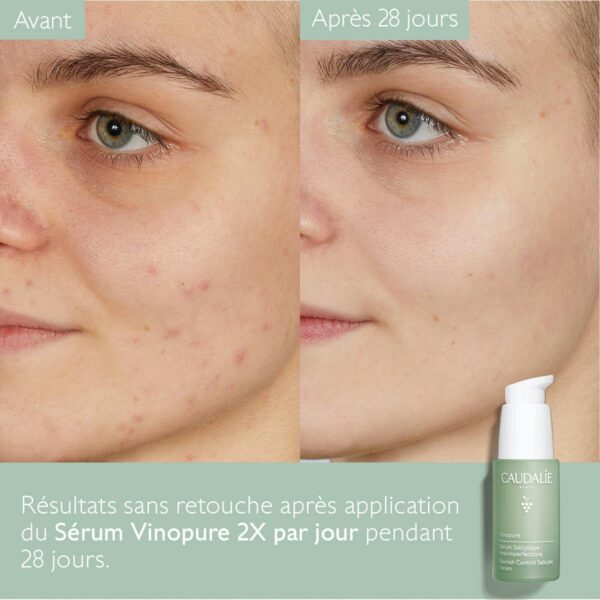 Caudalie Vinopure Serum 30ml - Image 6
